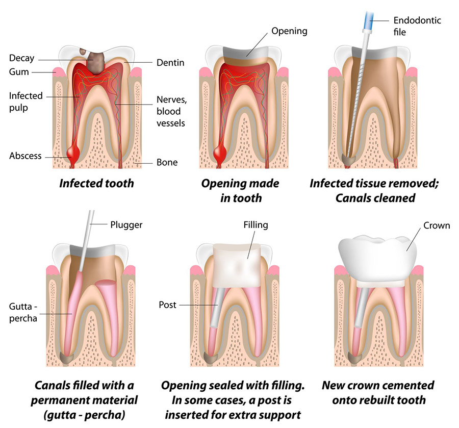 Kids Dentistry